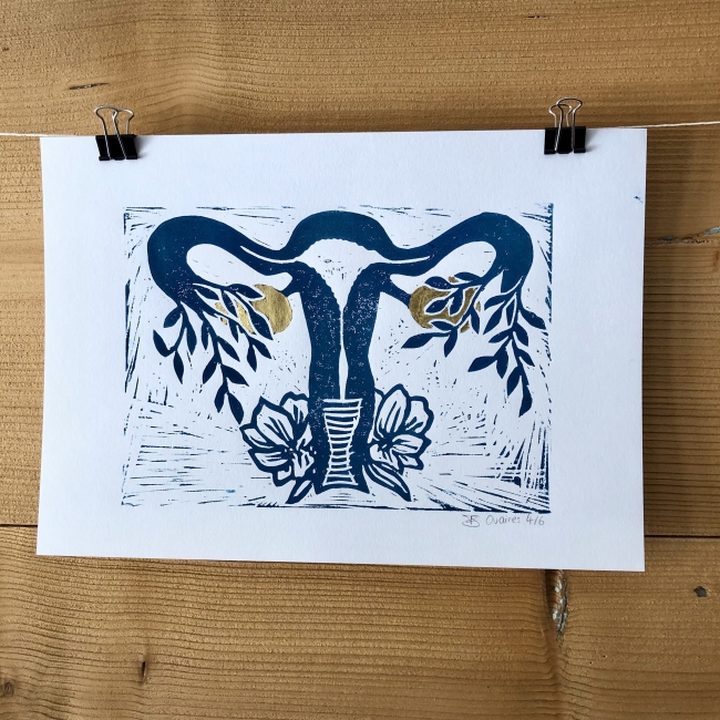 Linogravure utérus et ovaires d'or