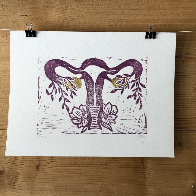 Linogravure utérus et ovaires d'or